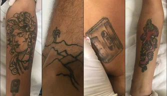 Tatuagens do paciente internado no HUT sem identificação.