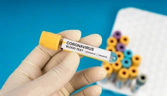 Teste coronavírus