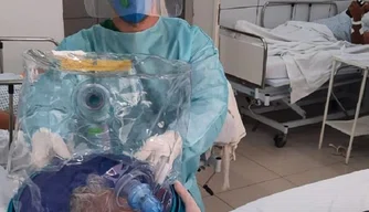 Capacete especial para terapia respiratória da Covid