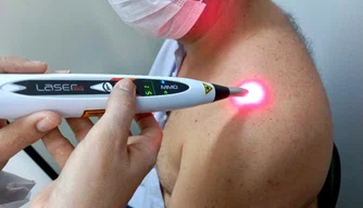 Laserterapia