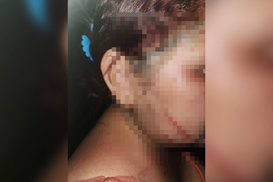 Mulher grávida é agredida pelo marido