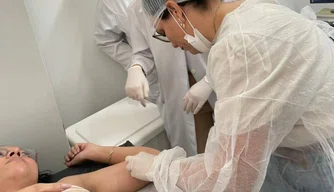 implanon, saúde feminino, contraceptivo